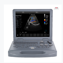 MT Selling portable ultrasound ultrasonic probe handheld veterinary ultrasound